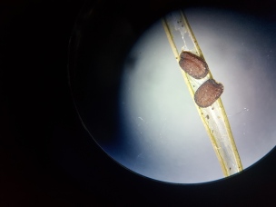 Seeds under microscope in pod